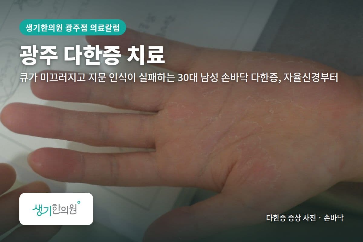 손바닥 다한증 증상 사진과 문구 「광주 다한증 치료, 큐가 미끄러지고 지문 인식이 실패하는 30대 남성 손바닥 다한증, 자율신경부터 · 생기한의원 광주점」
