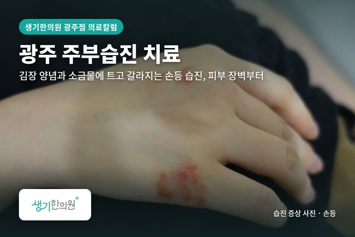 손등 주부습진 증상 사진과 문구 「광주 주부습진 치료, 김장 양념과 소금물에 트고 갈라지는 손등 습진, 피부 장벽부터 · 생기한의원 광주점」