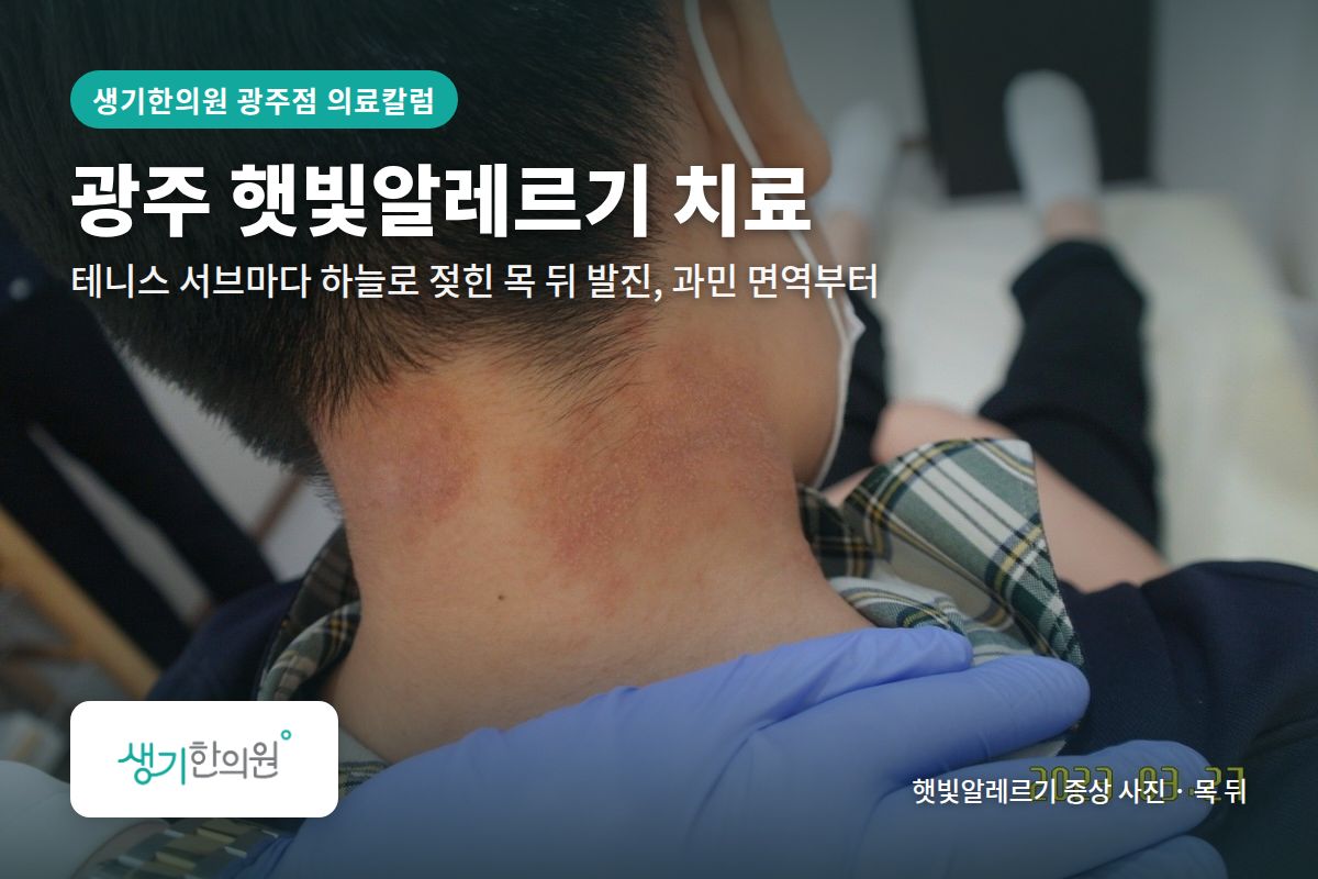 목 뒤 햇빛알레르기 증상 사진과 문구 「광주 햇빛알레르기 치료, 테니스 서브마다 하늘로 젖힌 목 뒤 발진, 과민 면역부터 · 생기한의원 광주점」